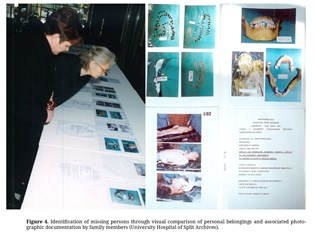Identifikacija nestalih osoba vizualnom usporedbom osobnih predmeta i pripadajuće fotografske dokumentacije članova obitelji- KB Split.jpg